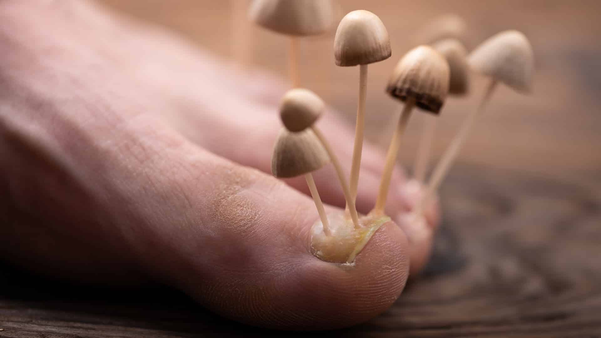 Mantar Hastalığı